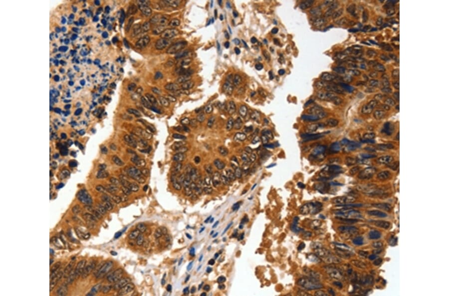 Immunohistochemistry - ADAP1 Antibody from Signalway Antibody (35561) - Antibodies.com