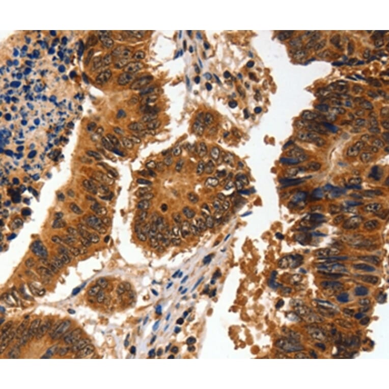 Immunohistochemistry - ADAP1 Antibody from Signalway Antibody (35561) - Antibodies.com