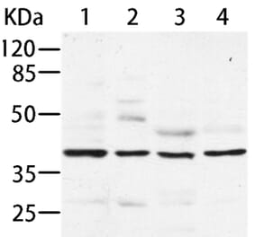 AIMP2 Antibody from Signalway Antibody (35586) - Antibodies.com