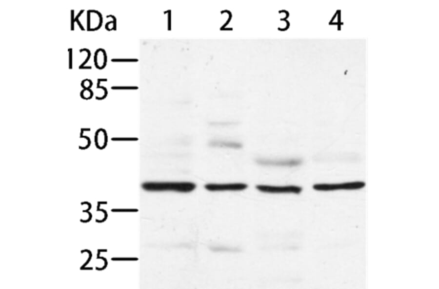 AIMP2 Antibody from Signalway Antibody (35586) - Antibodies.com