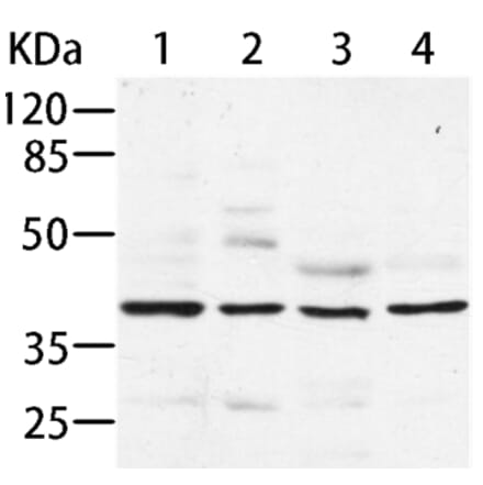 AIMP2 Antibody from Signalway Antibody (35586) - Antibodies.com