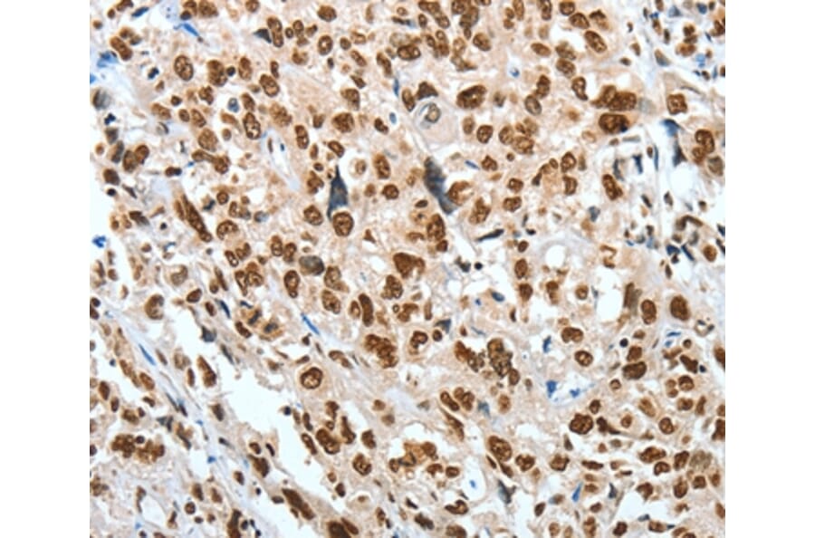 Immunohistochemistry - BNIP1 Antibody from Signalway Antibody (35597) - Antibodies.com