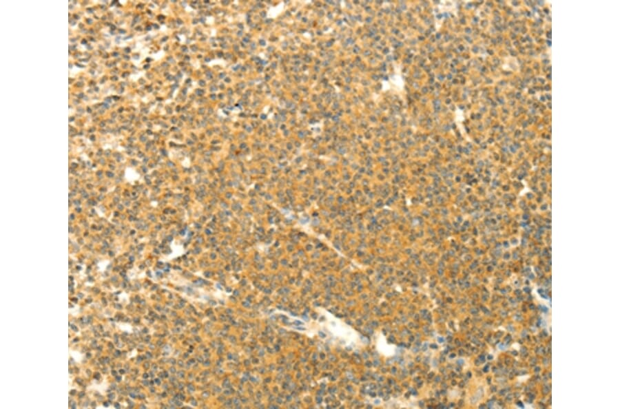 Immunohistochemistry - AARS2 Antibody from Signalway Antibody (35611) - Antibodies.com