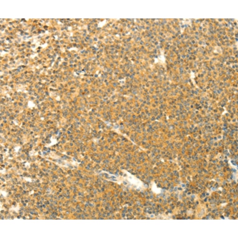Immunohistochemistry - AARS2 Antibody from Signalway Antibody (35611) - Antibodies.com