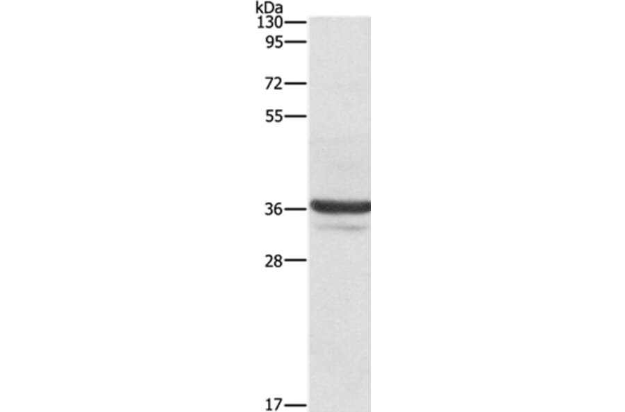 ANXA3 Antibody from Signalway Antibody (35619) - Antibodies.com