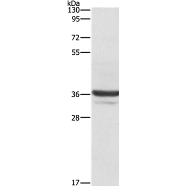 ANXA3 Antibody from Signalway Antibody (35619) - Antibodies.com