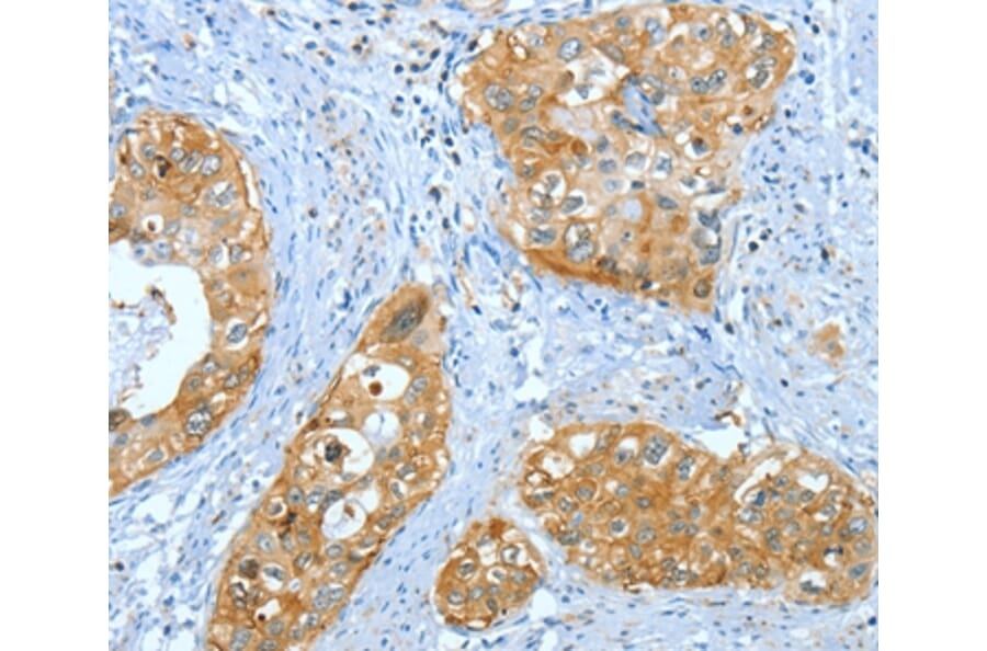 Immunohistochemistry - ANXA3 Antibody from Signalway Antibody (35619) - Antibodies.com