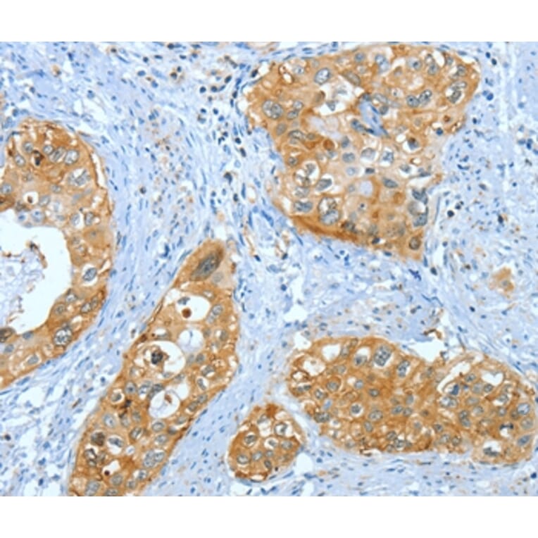 Immunohistochemistry - ANXA3 Antibody from Signalway Antibody (35619) - Antibodies.com