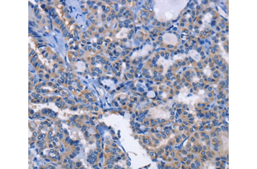Immunohistochemistry - ANXA4 Antibody from Signalway Antibody (35620) - Antibodies.com