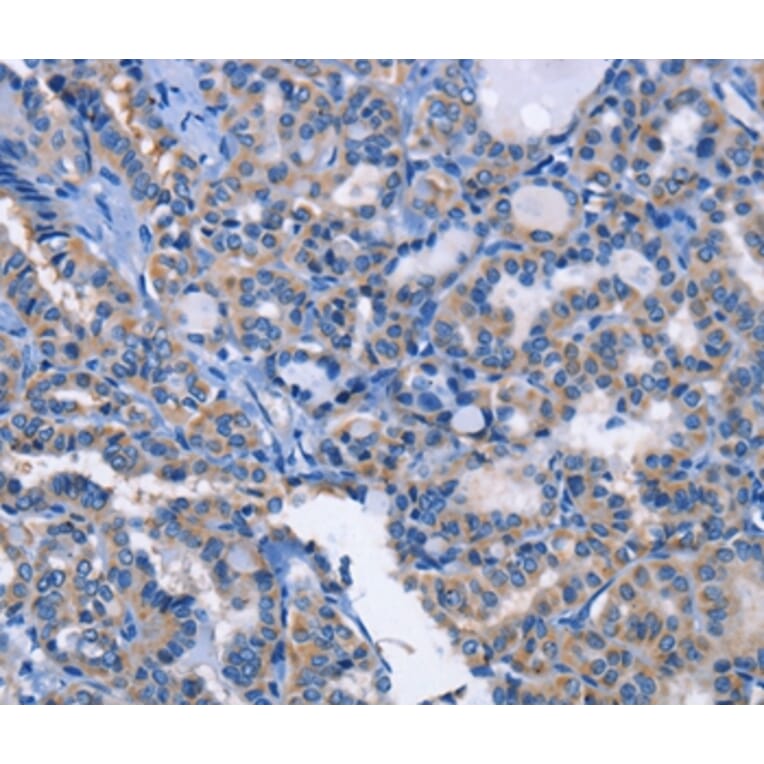 Immunohistochemistry - ANXA4 Antibody from Signalway Antibody (35620) - Antibodies.com