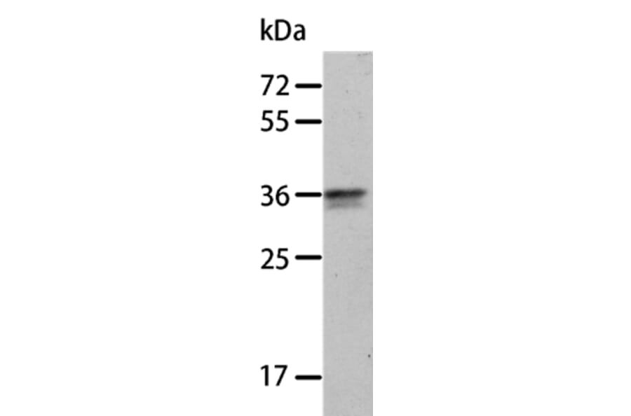 ANXA8 Antibody from Signalway Antibody (35621) - Antibodies.com