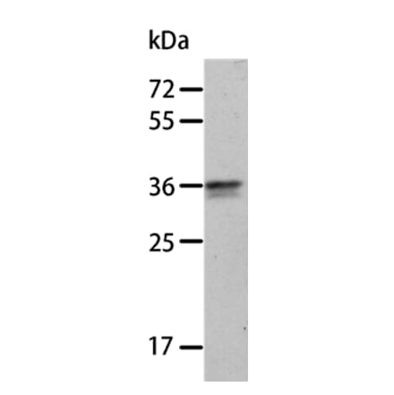 ANXA8 Antibody from Signalway Antibody (35621) - Antibodies.com