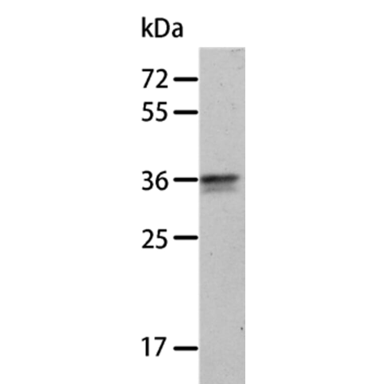 ANXA8 Antibody from Signalway Antibody (35621) - Antibodies.com