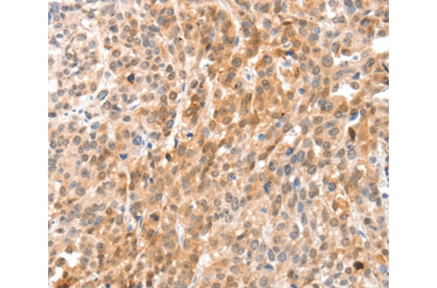Immunohistochemistry - ANXA8 Antibody from Signalway Antibody (35621) - Antibodies.com