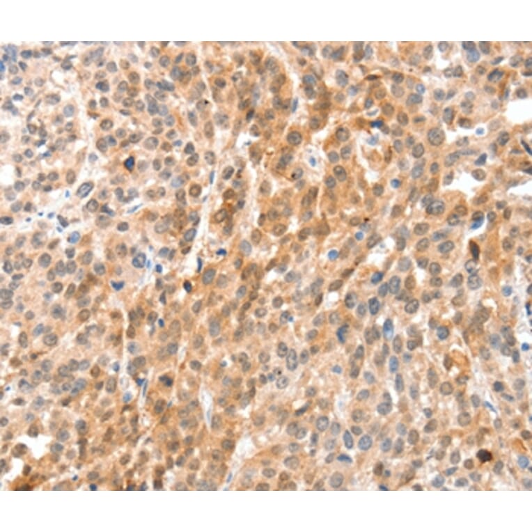 Immunohistochemistry - ANXA8 Antibody from Signalway Antibody (35621) - Antibodies.com