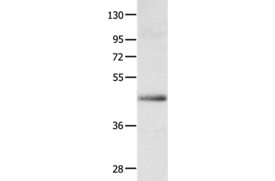 APLNR Antibody from Signalway Antibody (35623) - Antibodies.com