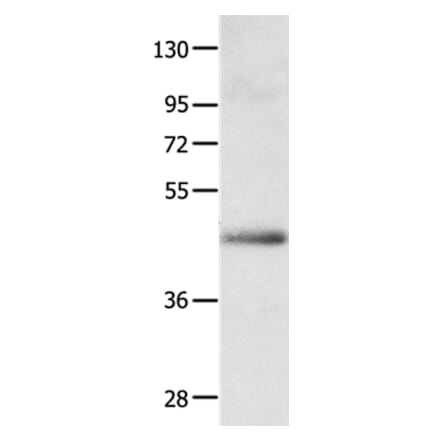APLNR Antibody from Signalway Antibody (35623) - Antibodies.com