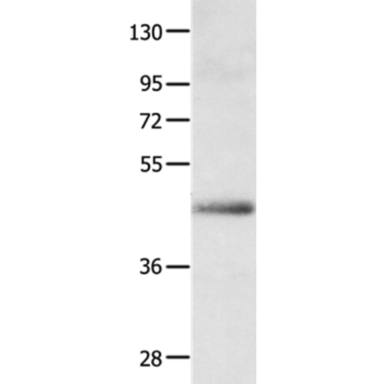 APLNR Antibody from Signalway Antibody (35623) - Antibodies.com