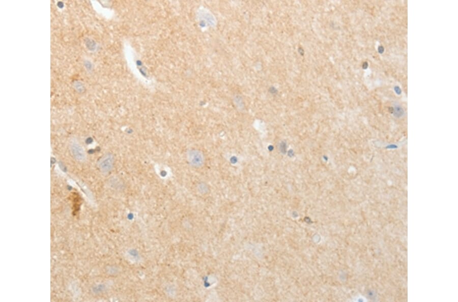 Immunohistochemistry - APLNR Antibody from Signalway Antibody (35623) - Antibodies.com