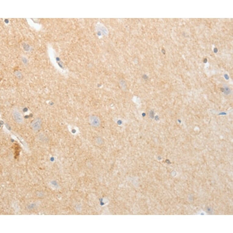 Immunohistochemistry - APLNR Antibody from Signalway Antibody (35623) - Antibodies.com