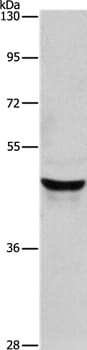 Gel: 8% SDS-PAGE Lysate: 40ug Lovo cell Primary antibody: 1/950 dilution Secondary antibody dilution: 1/8000 Exposure time: 10 seconds