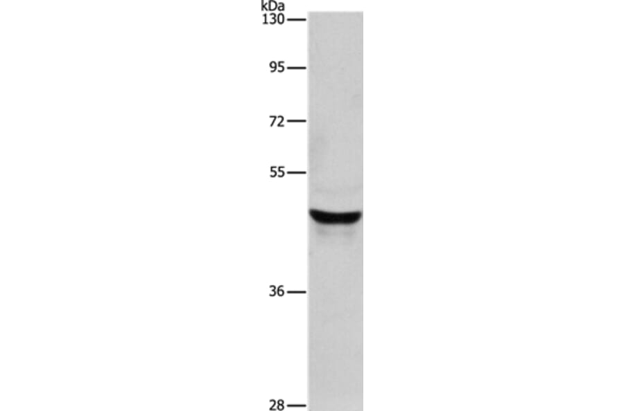 KRT40 Antibody from Signalway Antibody (35629) - Antibodies.com