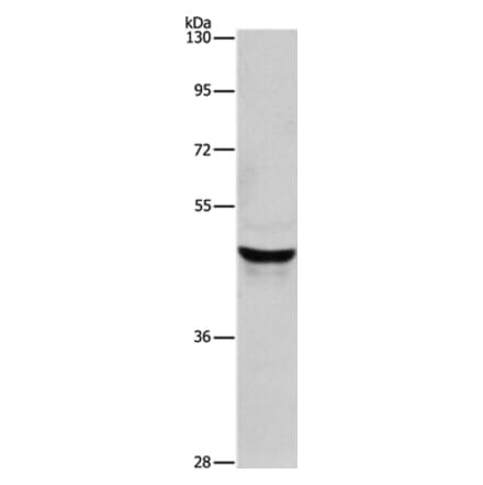 KRT40 Antibody from Signalway Antibody (35629) - Antibodies.com