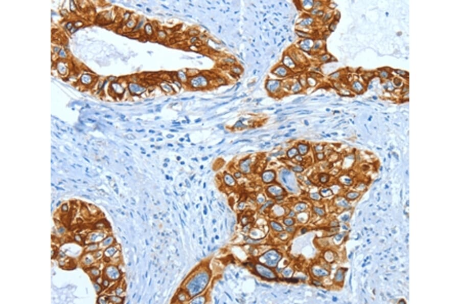 Immunohistochemistry - KRT40 Antibody from Signalway Antibody (35629) - Antibodies.com