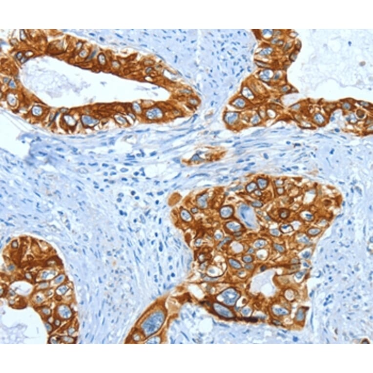 Immunohistochemistry - KRT40 Antibody from Signalway Antibody (35629) - Antibodies.com