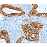 Immunohistochemistry - KRT40 Antibody from Signalway Antibody (35629) - Antibodies.com