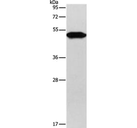 KRT81 Antibody from Signalway Antibody (35630) - Antibodies.com