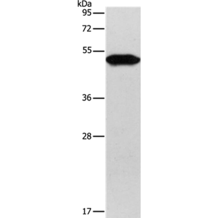 KRT81 Antibody from Signalway Antibody (35630) - Antibodies.com