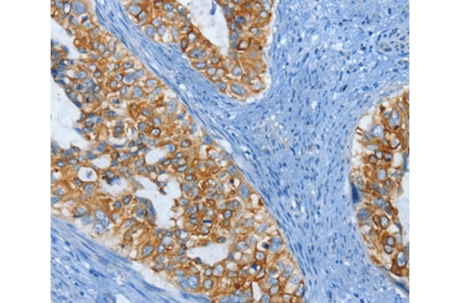 Immunohistochemistry - KRT81 Antibody from Signalway Antibody (35630) - Antibodies.com