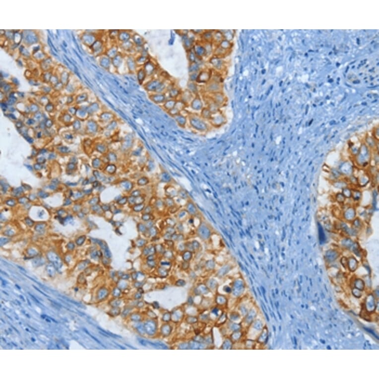 Immunohistochemistry - KRT81 Antibody from Signalway Antibody (35630) - Antibodies.com