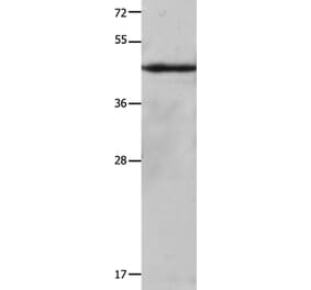 KRT23 Antibody from Signalway Antibody (35632) - Antibodies.com
