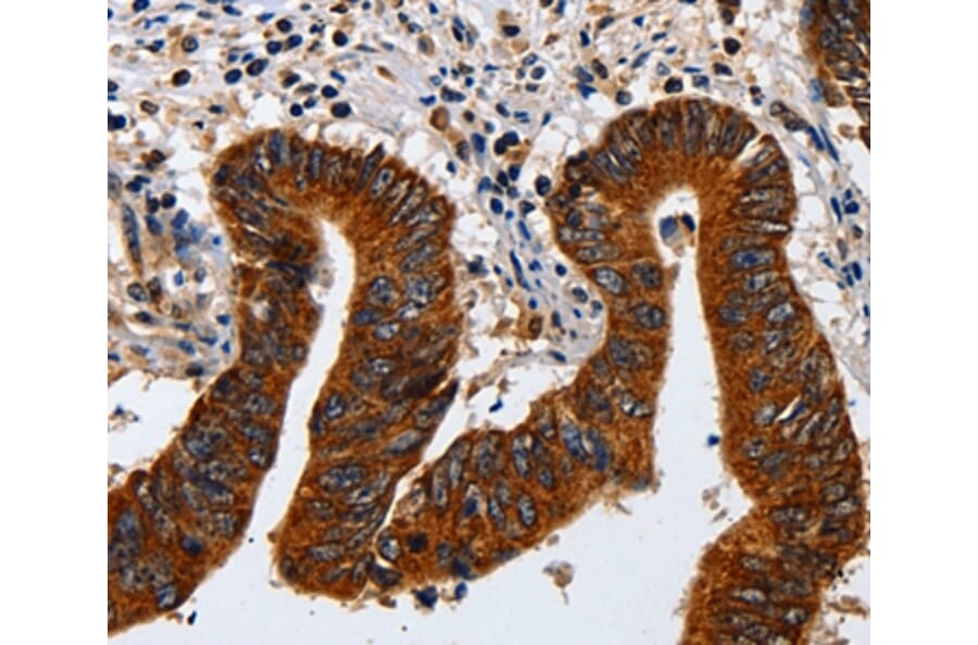 Immunohistochemistry - KRT23 Antibody from Signalway Antibody (35632) - Antibodies.com