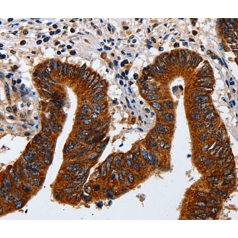 Immunohistochemistry - KRT23 Antibody from Signalway Antibody (35632) - Antibodies.com