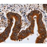 Immunohistochemistry - KRT23 Antibody from Signalway Antibody (35632) - Antibodies.com