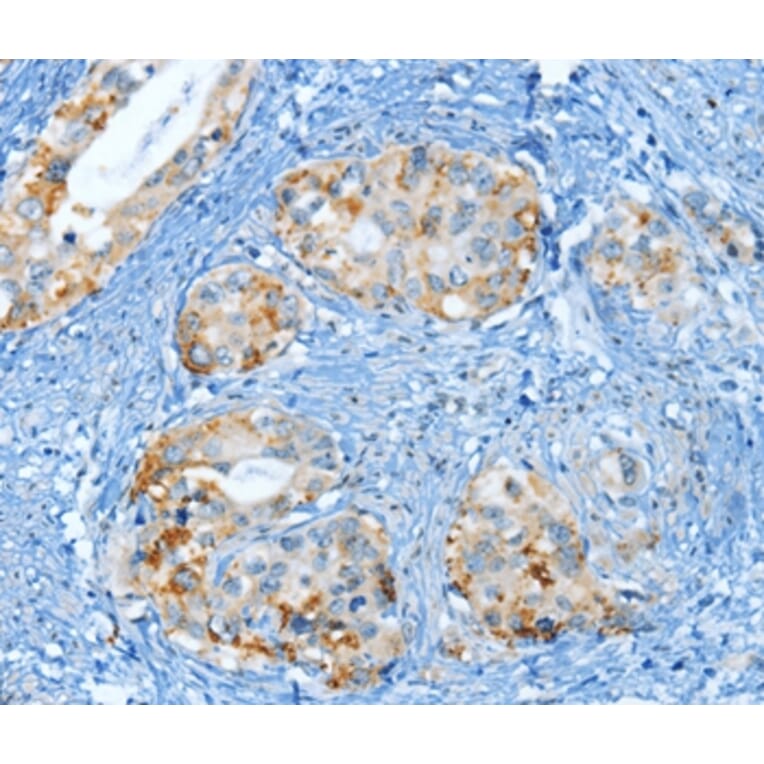 Immunohistochemistry - MUC15 Antibody from Signalway Antibody (35635) - Antibodies.com