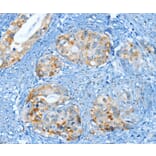 Immunohistochemistry - MUC15 Antibody from Signalway Antibody (35635) - Antibodies.com