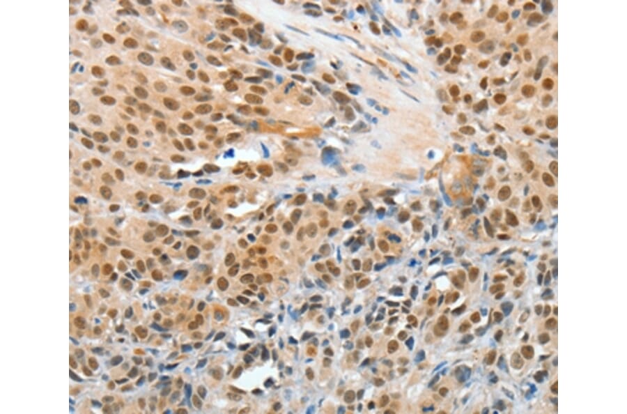 Immunohistochemistry - APPL1 Antibody from Signalway Antibody (35645) - Antibodies.com