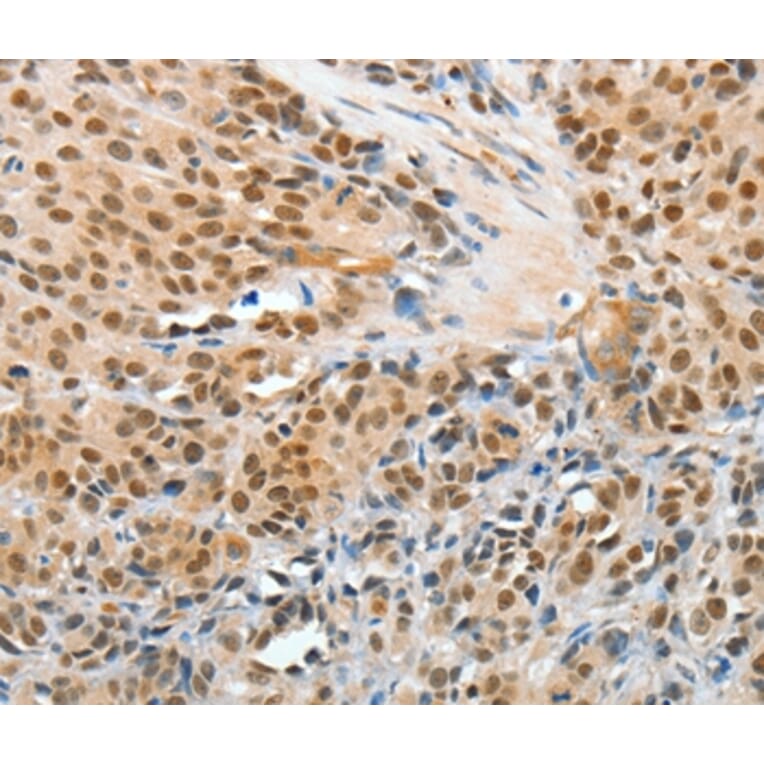 Immunohistochemistry - APPL1 Antibody from Signalway Antibody (35645) - Antibodies.com