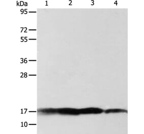 ATP5J Antibody from Signalway Antibody (35649) - Antibodies.com