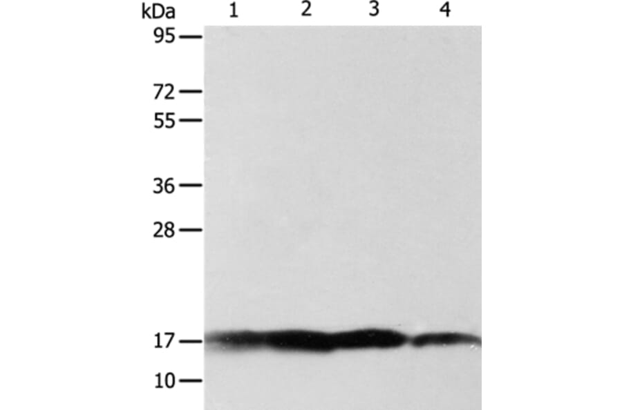 ATP5J Antibody from Signalway Antibody (35649) - Antibodies.com