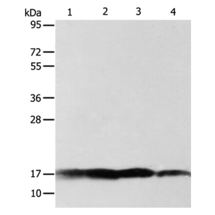 ATP5J Antibody from Signalway Antibody (35649) - Antibodies.com