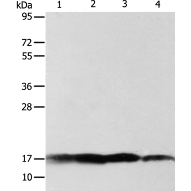 ATP5J Antibody from Signalway Antibody (35649) - Antibodies.com