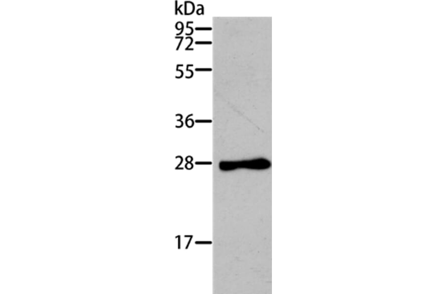 TNNI3 Antibody from Signalway Antibody (35662) - Antibodies.com