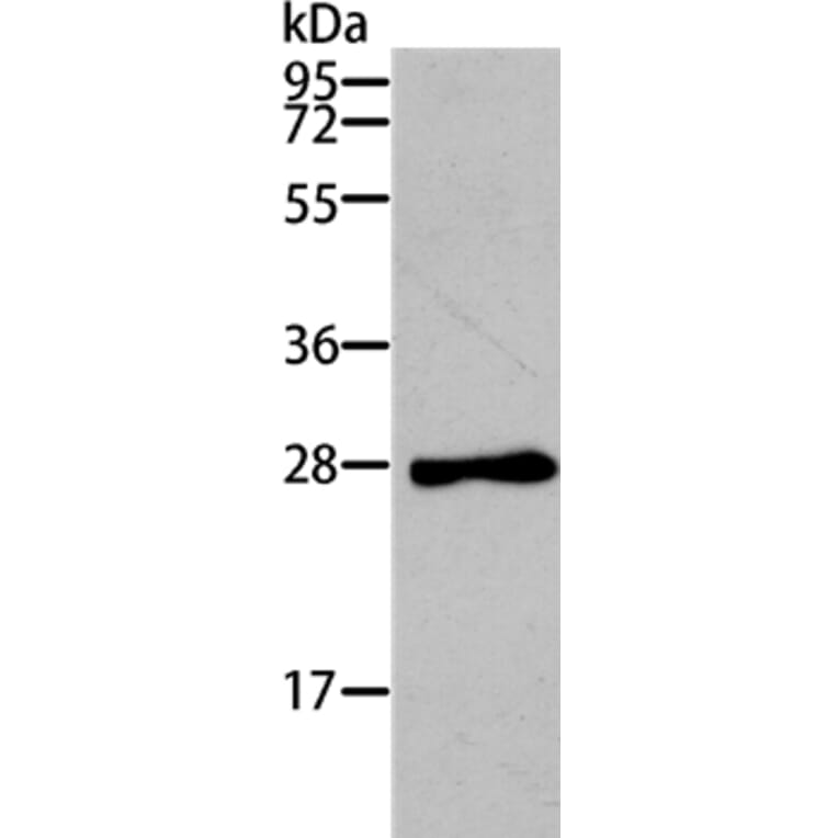 TNNI3 Antibody from Signalway Antibody (35662) - Antibodies.com
