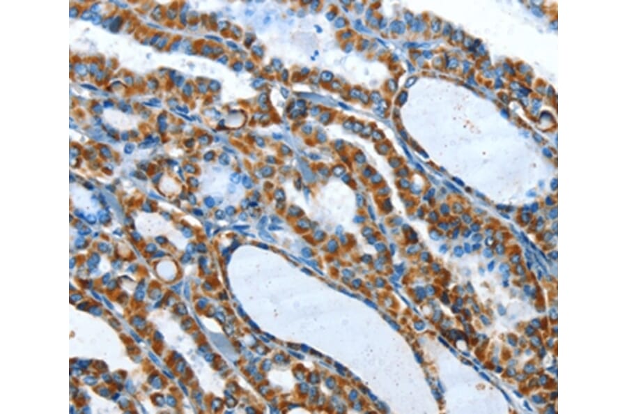 Immunohistochemistry - TNNI3 Antibody from Signalway Antibody (35662) - Antibodies.com