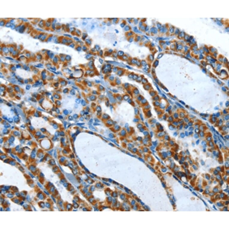 Immunohistochemistry - TNNI3 Antibody from Signalway Antibody (35662) - Antibodies.com
